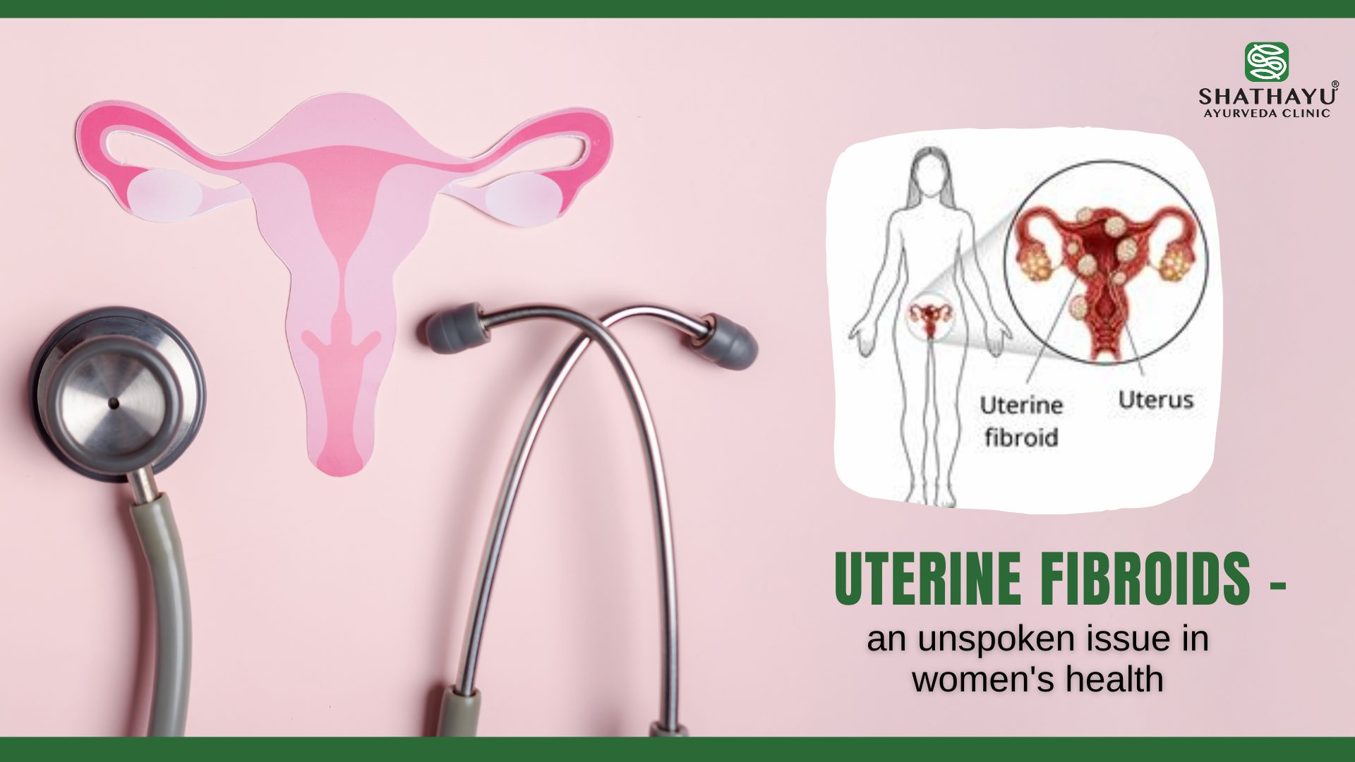 Uterine fibroids an unspoken issue in women’s health 